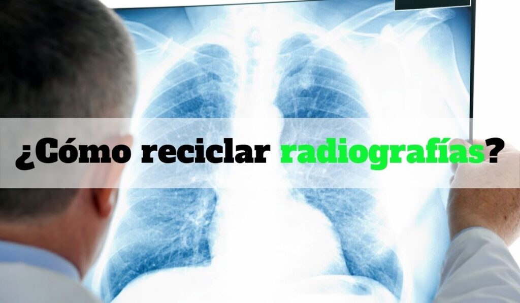 ¿Cómo reciclar radiografías?